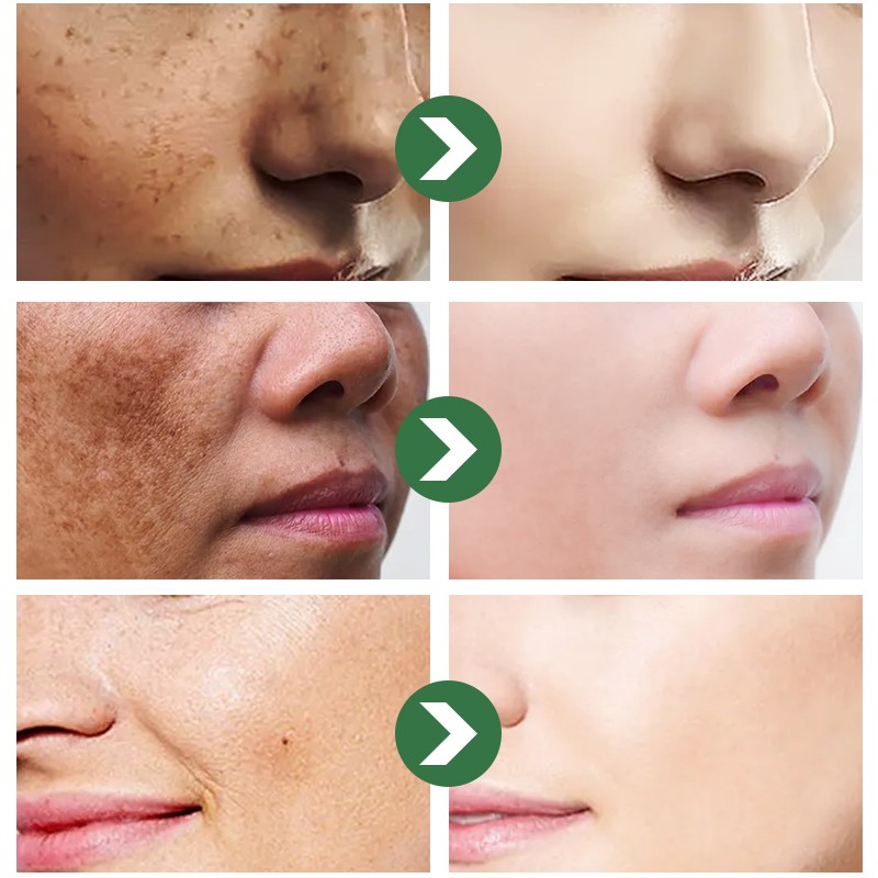 Exfoliating Gel Manufacturer - OEM/ODM Private Label Peeling Face Body Dead Skin Remover