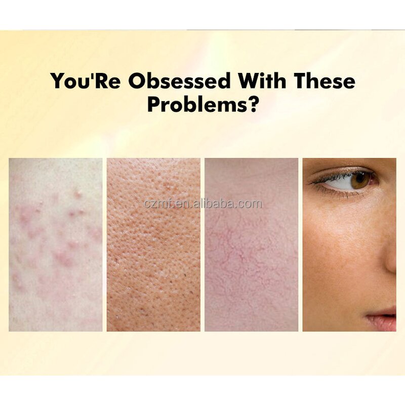 Green Tea Face Clay Mask Manufacturer - OEM/ODM Private Label Beauty Products Anti Aging