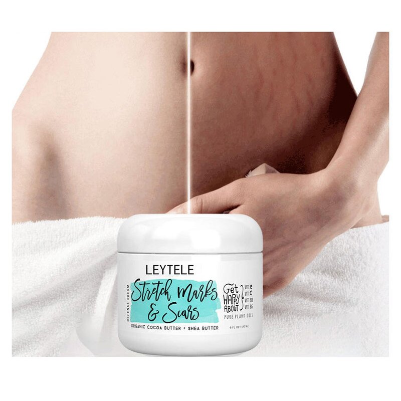 Stretch Mark Cream Manufacturer - OEM/ODM Natural Organic Postpartum Skin Repair