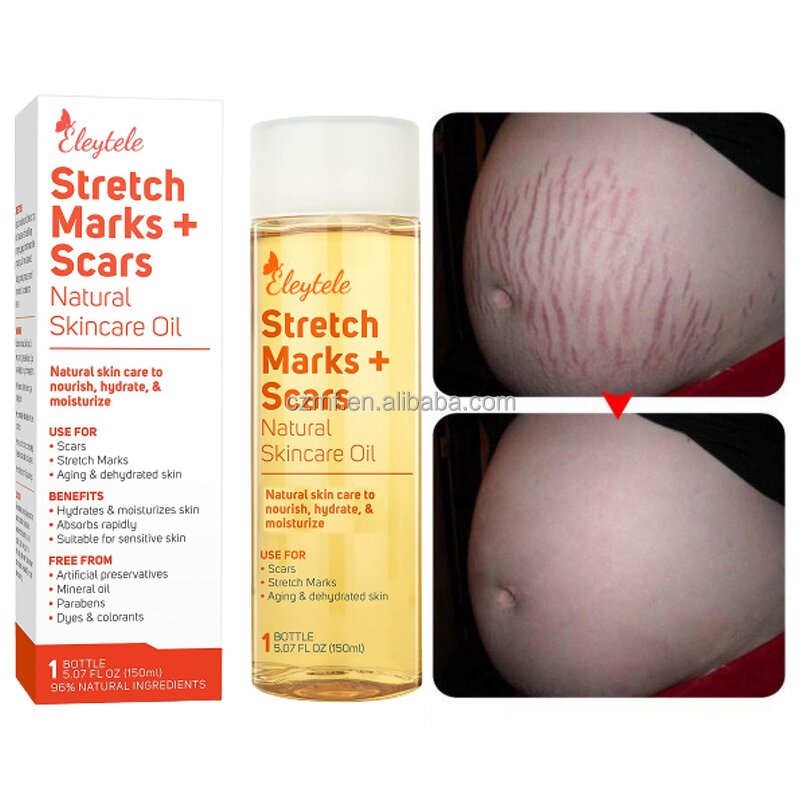 Stretch Mark Oil Manufacturer - OEM/ODM Private Label Natural Plant Regenerating Body