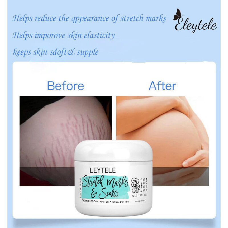 Stretch Mark Cream Manufacturer - OEM/ODM Natural Organic Postpartum Skin Repair