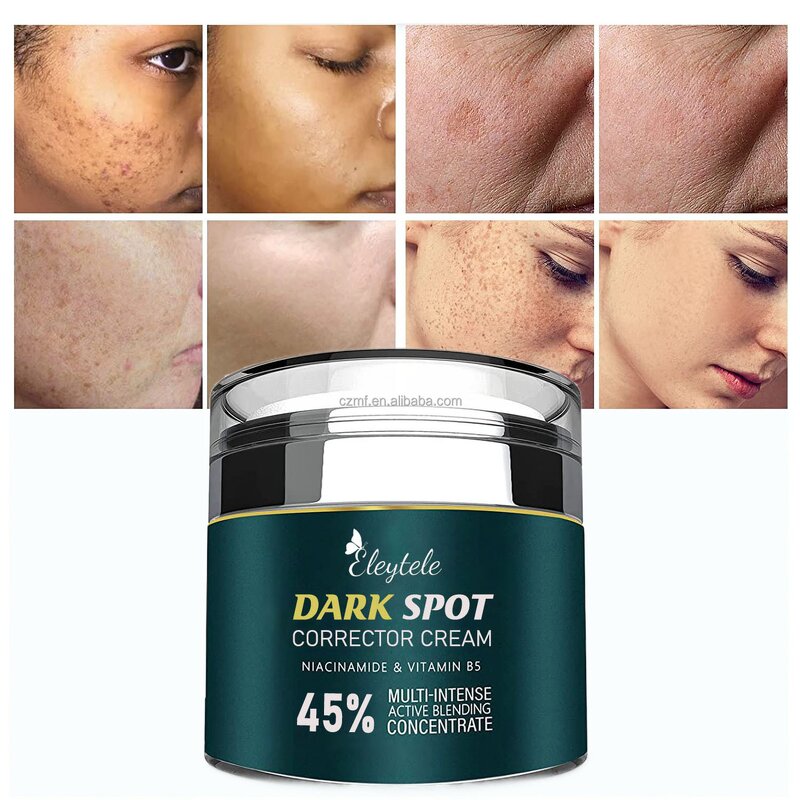 Dark Spot Remover Cream Manufacturer - OEM/ODM Natural Pimples Melasma Bleaching
