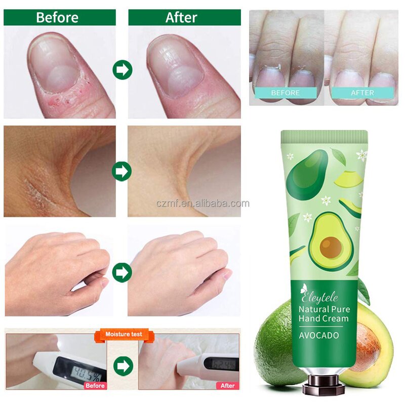 Hand Cream Tube Manufacturer - OEM/ODM Custom Wholesale Hot Selling Whitening