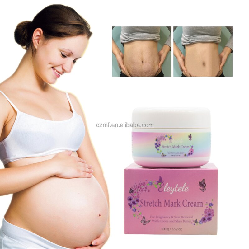 Stretch Mark Cream Manufacturer - OEM/ODM Private Label Skin Care Repair Organic Shea