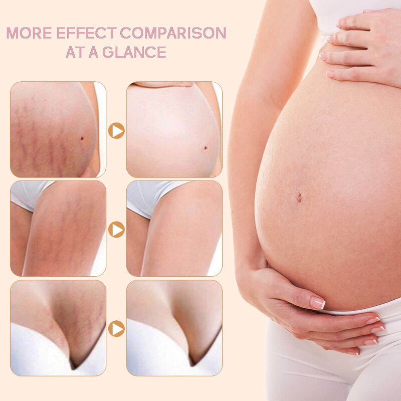 Slimming Patch Manufacturer - OEM/ODM Wholesale Organic Fat Burning Herbal Belly Button