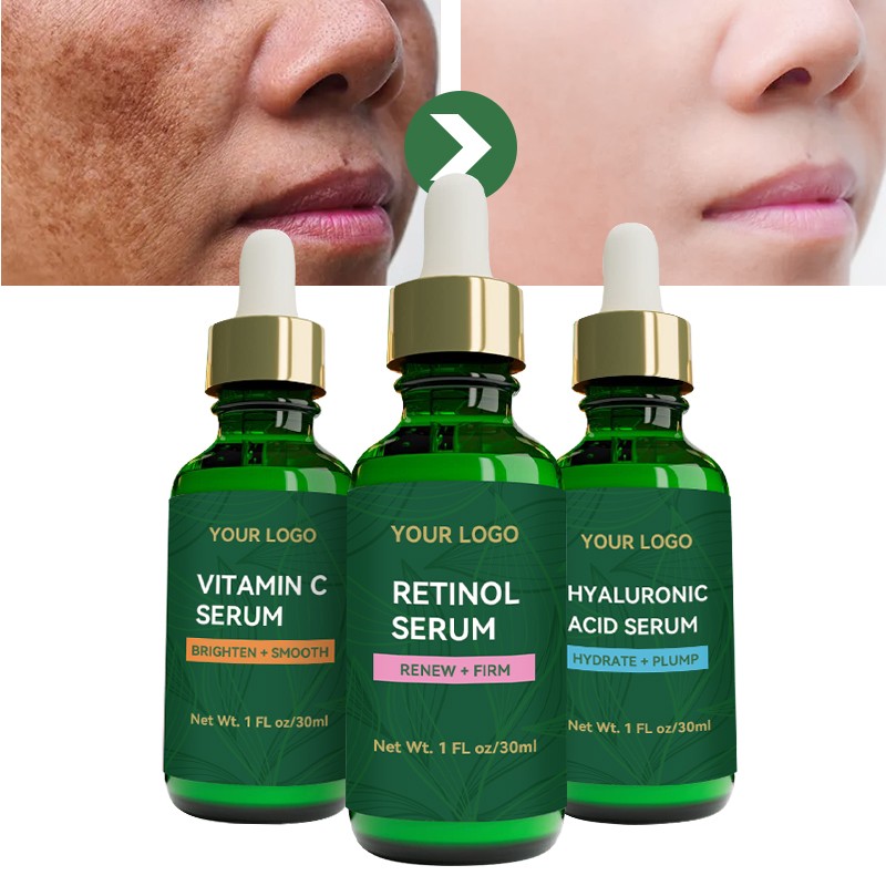 Exfoliating Gel Manufacturer - OEM/ODM Private Label Peeling Face Body Dead Skin Remover