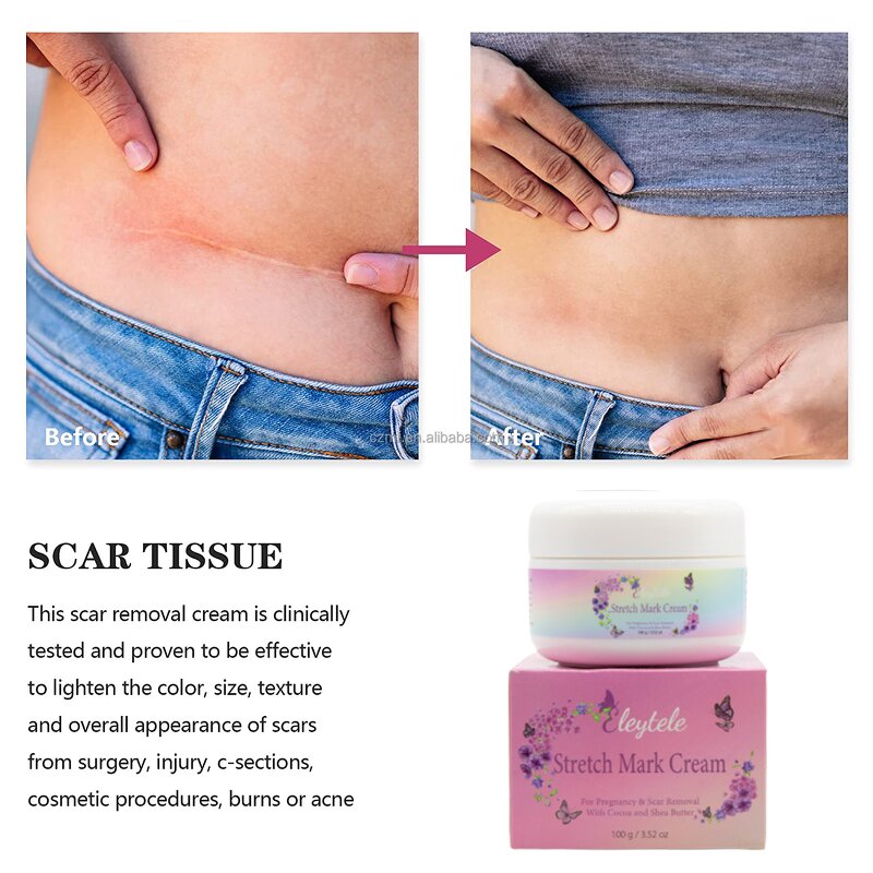 Stretch Mark Cream Manufacturer - OEM/ODM Wholesale Natural Maternity Private Label