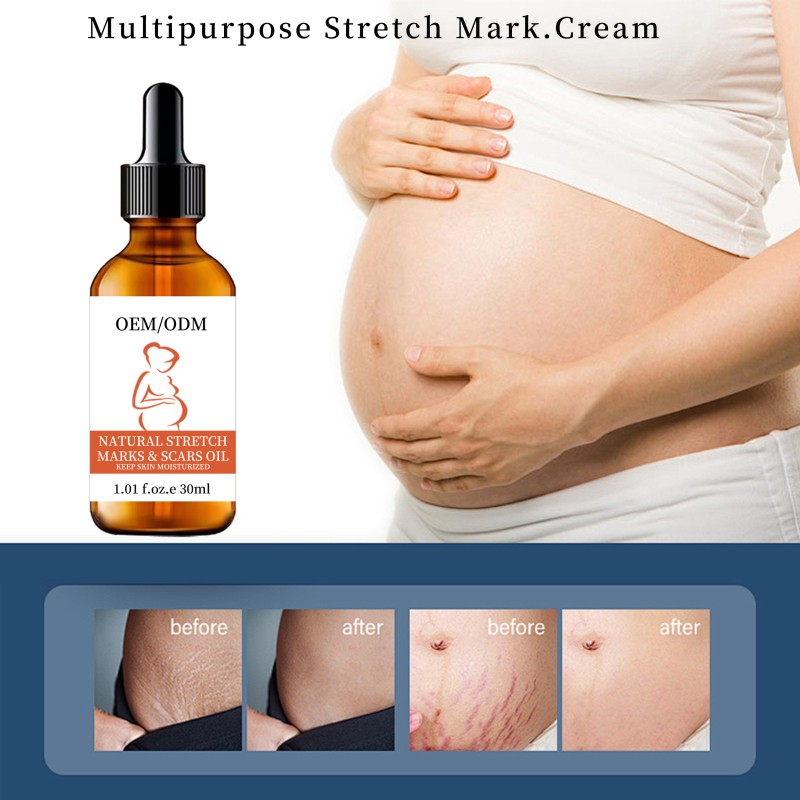 Body Oil Factory - Natural Organic Stretch Marks Removal Massage