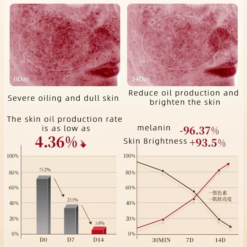 Face Wash Supplier - ODM Deep Cleansing Anti-Acne Blackhead Removal