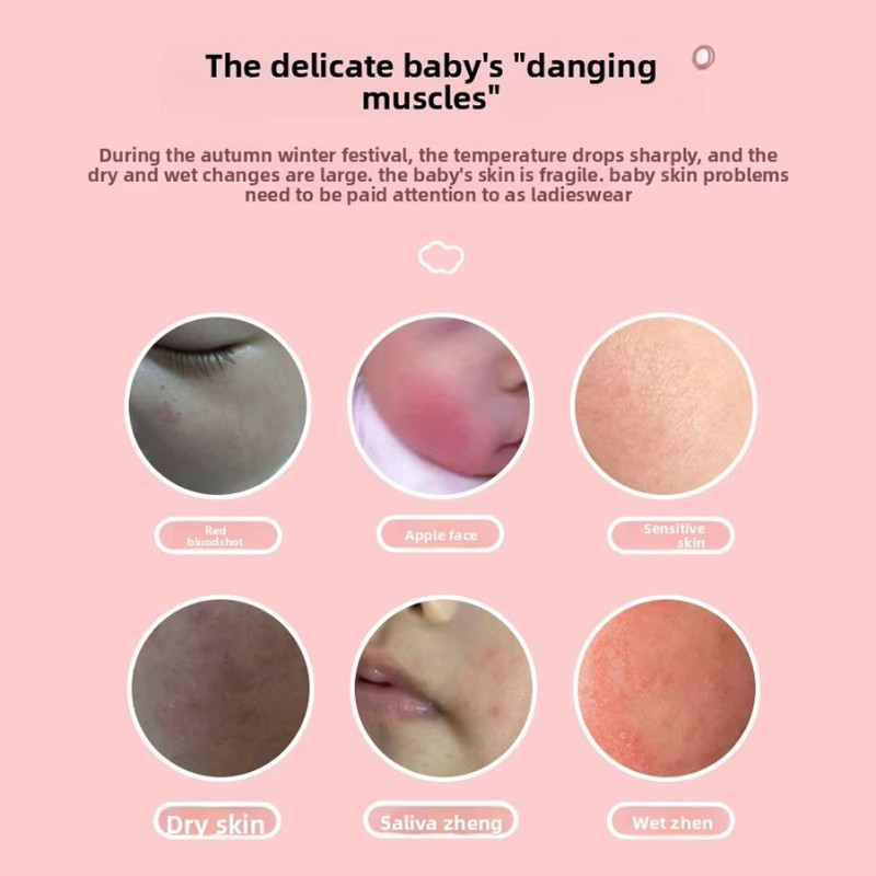 Kids Face Cream Supplier - OEM Custom Moisturizing Milk Anti-Chapping