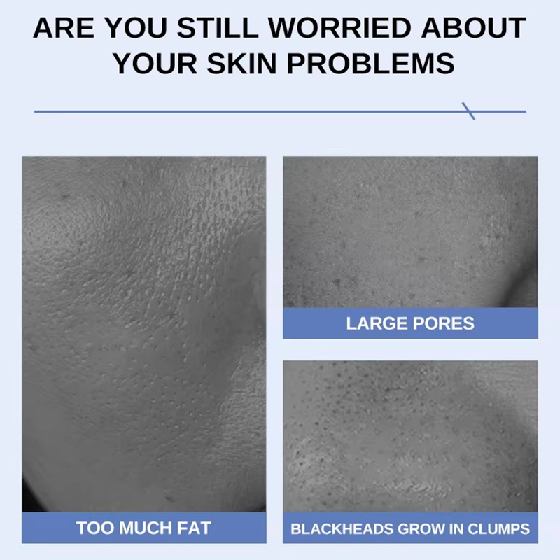 Night Cream Supplier - Hyaluronic Acid Capsule Collagen Filling