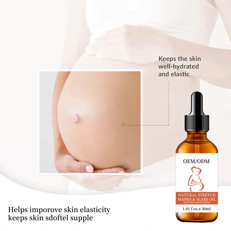 Body Oil Factory - Natural Organic Stretch Marks Removal Massage