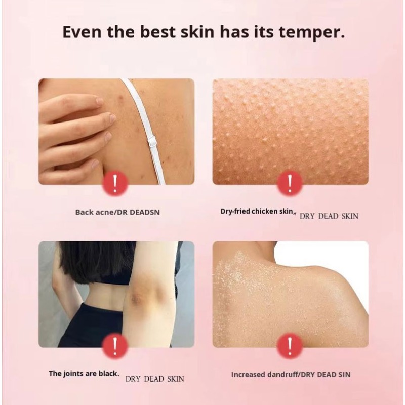 Body Cream Supplier - Custom OEM Gentle Exfoliating Moisturizing