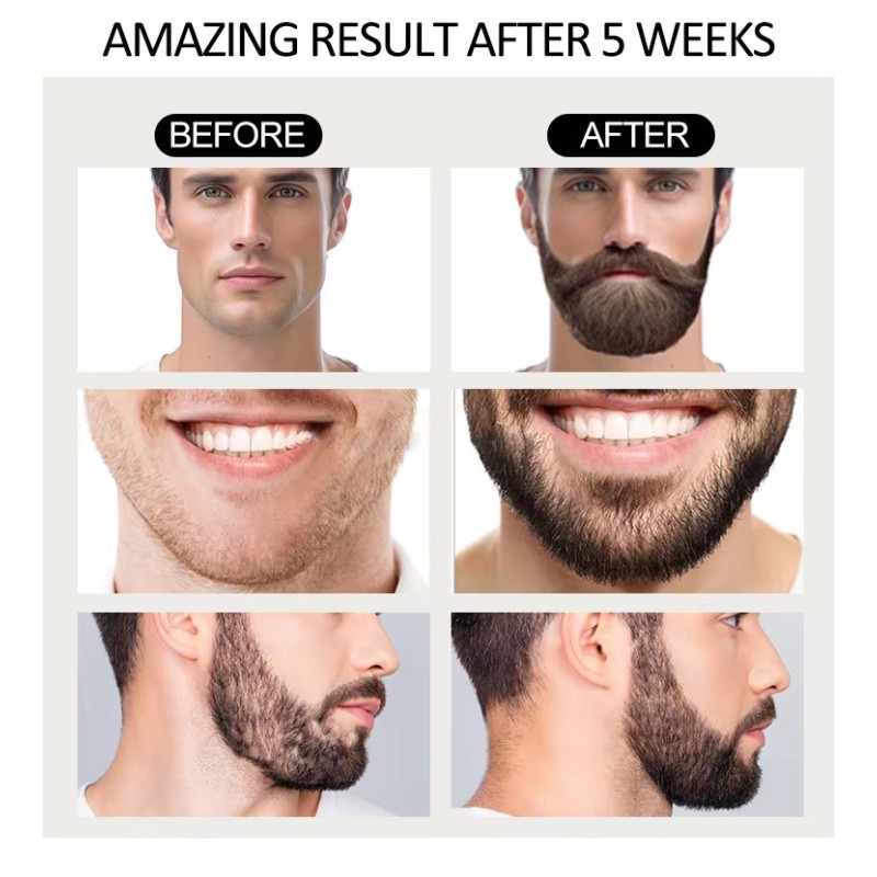 Beard Oil Supplier - Private Label 100% Pure Organic Fast Growth