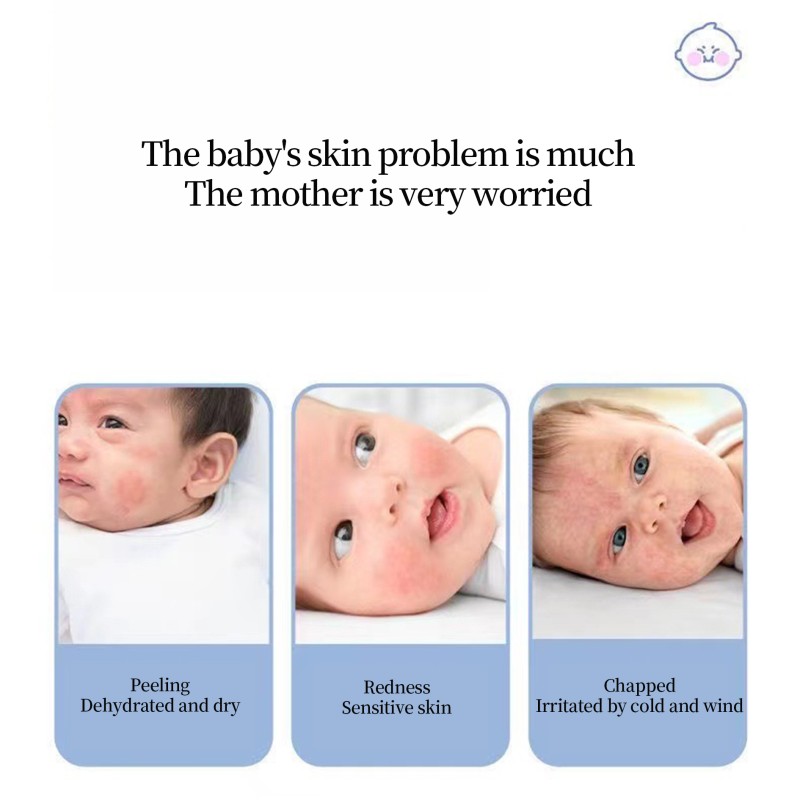 Baby Face Cream Supplier - Wholesale Natural Organic Dry Skin Prevention