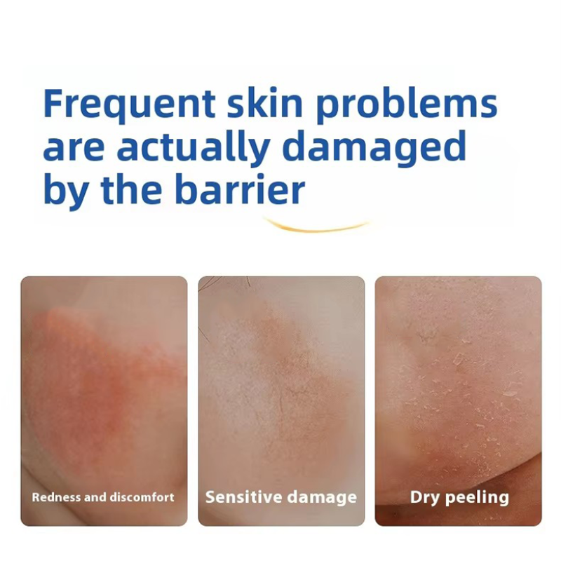 Baby Face Cream Manufacturer - Calendula Hydrating Balm Skin Care