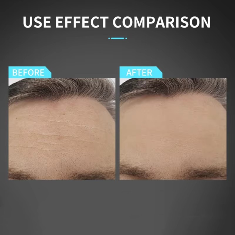 Men Face Cream Manufacturer - Dark Spot Removal Retinol GMP Certified