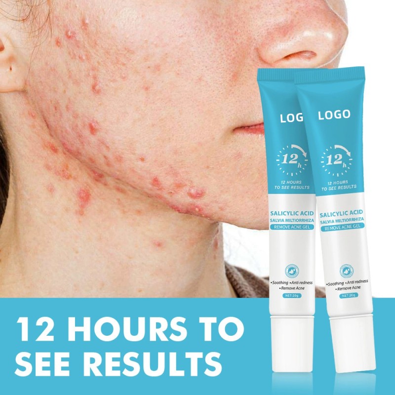 Acne Gel Supplier - Salicylic Acid Plant Essence Night Use Gel