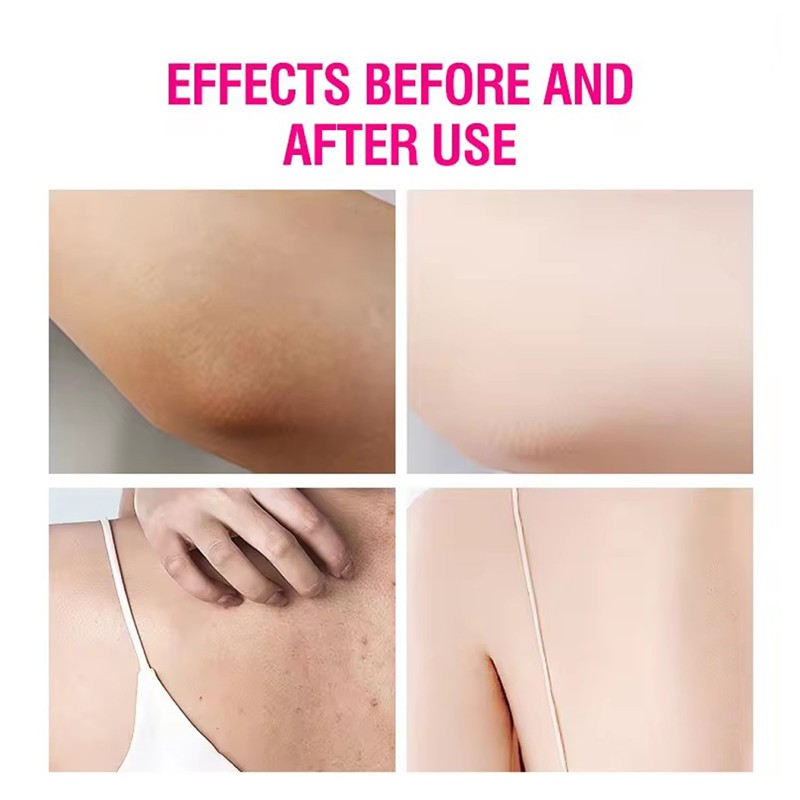 Body Cream Supplier - OEM Face Body Brightening 3 Days Whitening