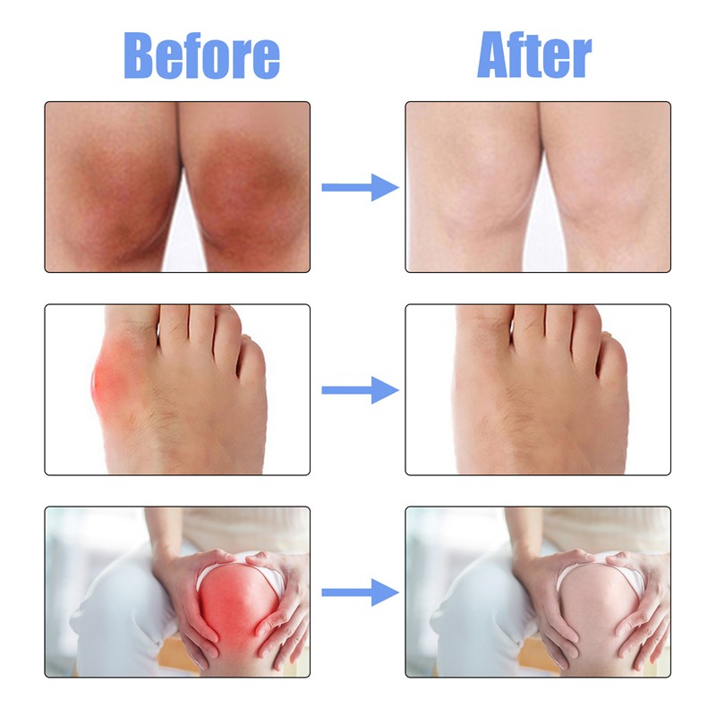 Joint Pain Relief Spray Manufacturer - Private Label South Moon 30ml Restorative Elbow