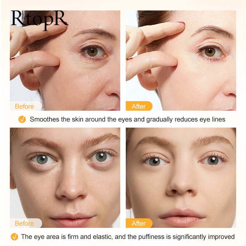 Vitamin C Eye Cream Manufacturer - Private Label Skin Moisturizing Dark Circles Improving