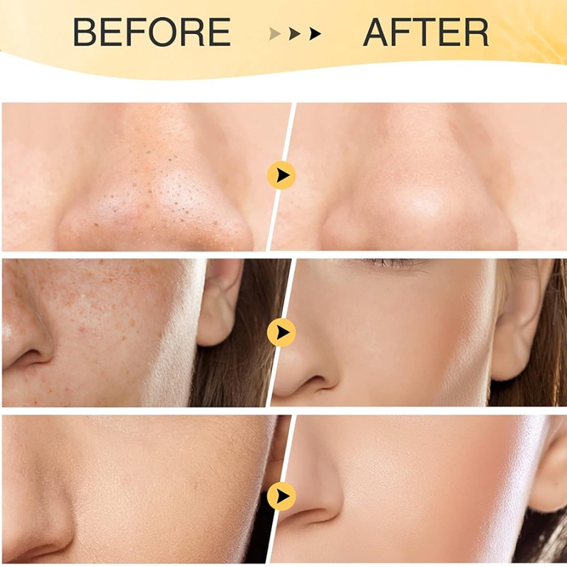 Turmeric Mud Mask Manufacturer - ODM/OEM Private Label Skincare Whitening Moisturizing