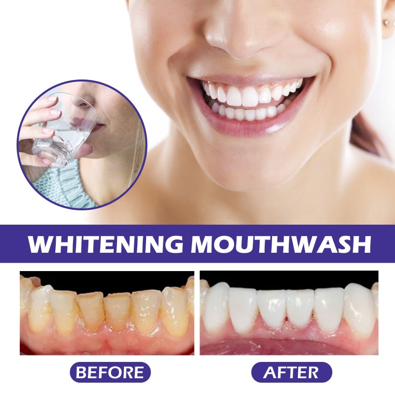 Probiotic Mouthwash Manufacturer - OEM Private Label Custom Refreshing Portable Oral