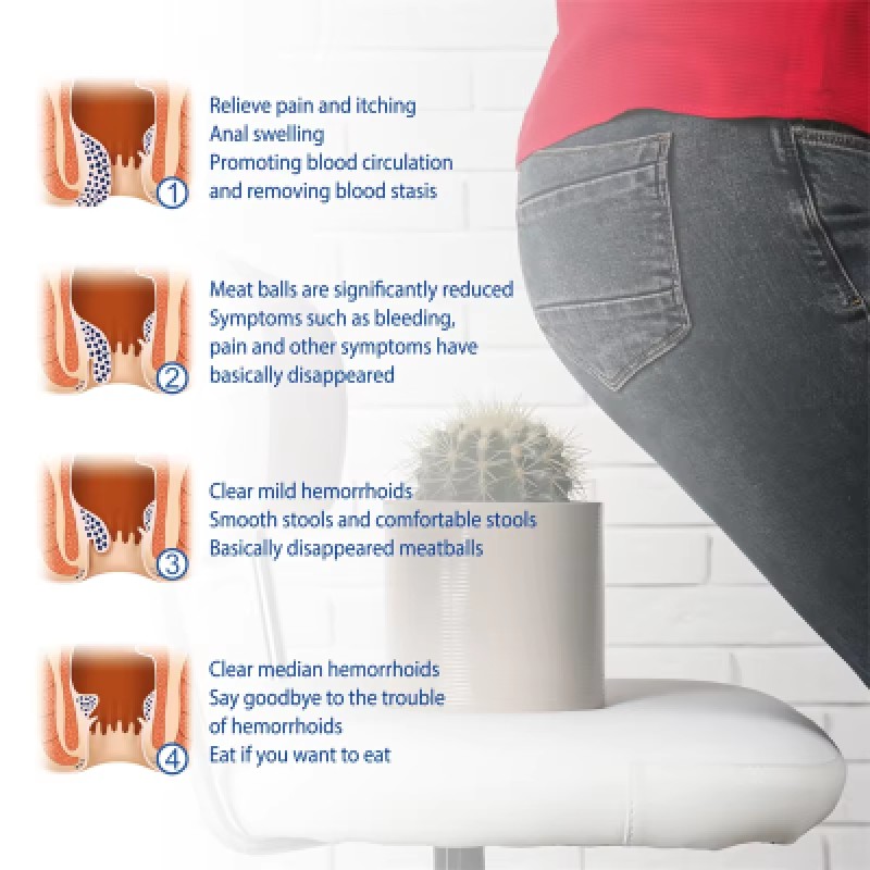 Hemorrhoids Cream Manufacturer - Private Label Anal Fissure Itching Swelling Treatment