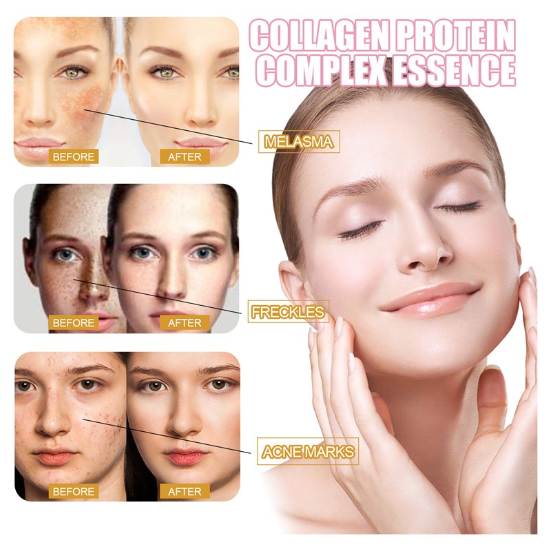 Face Serum Manufacturer - OEM 15ml Hydrolyzed Placenta Collagen Rose Oil Essence