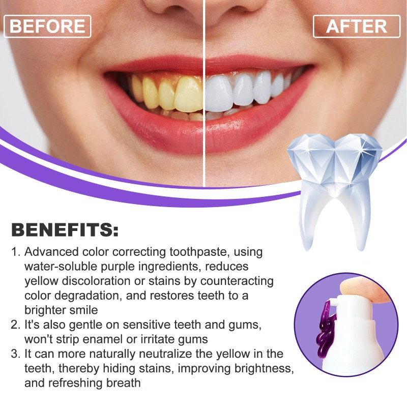 Purple Whitening Toothpaste Manufacturer - OEM/ODM Wholesale Private Label Custom 30ml