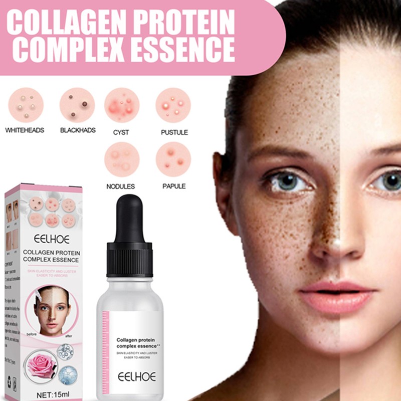 Face Serum Manufacturer - OEM 15ml Hydrolyzed Placenta Collagen Rose Oil Essence