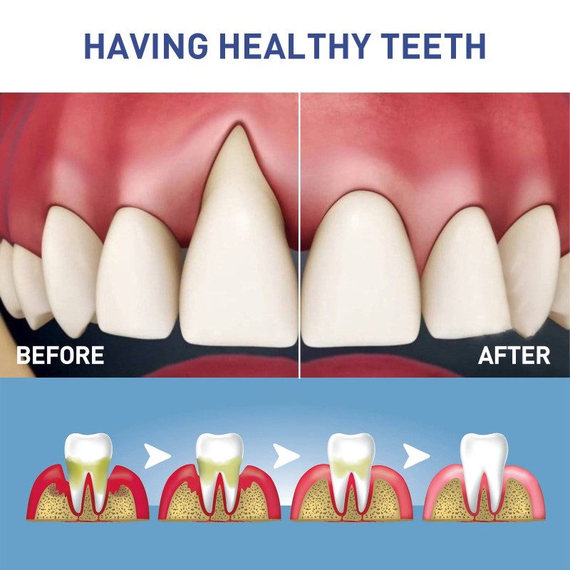 Gingival Care Gel Manufacturer - Private Label Oem Tooth Whitening Relieves Gum Degeneration
