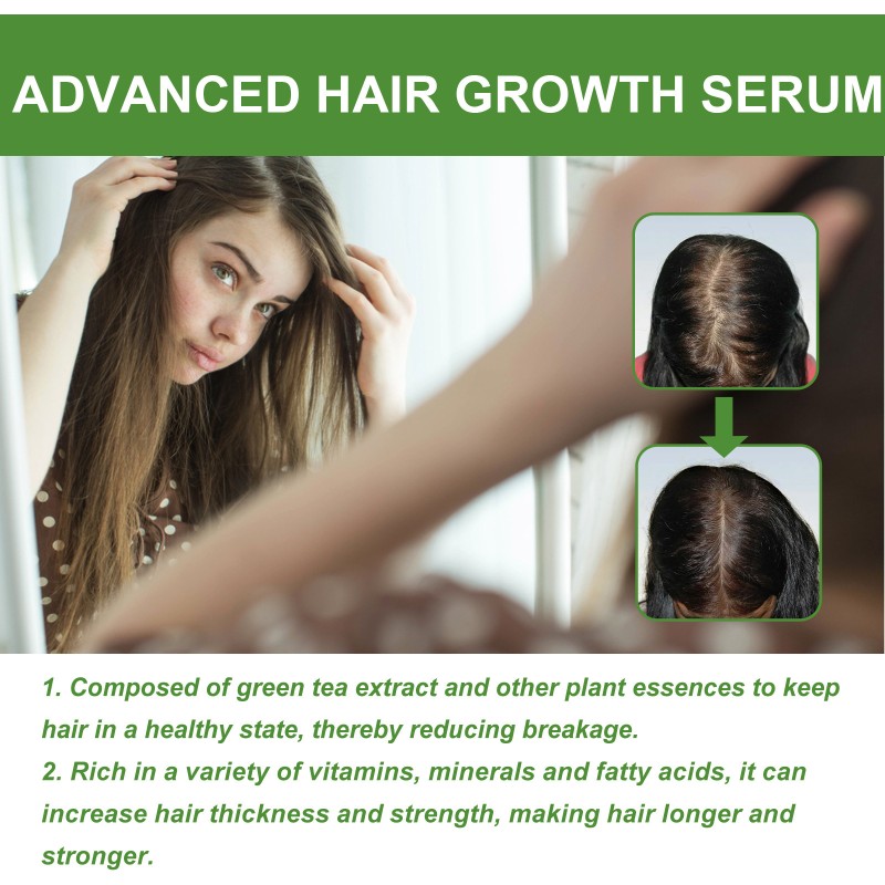 Hair Growth Serum Manufacturer - Custom Private Label EELHOE Advanced Stimulate Roots