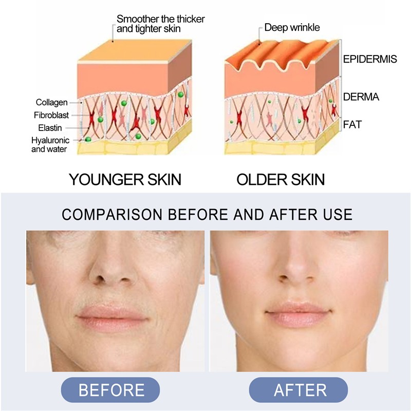 Face Serum Ampoule Manufacturer - OEM Lift Firm Pro Collagen Super Spots Wrinkles