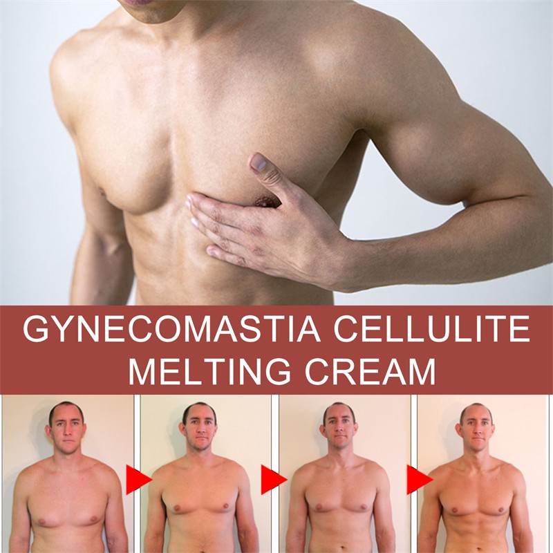 Male Breast Cream Manufacturer - OEM South Moon Gynecomastia Cellulite Melting Chest