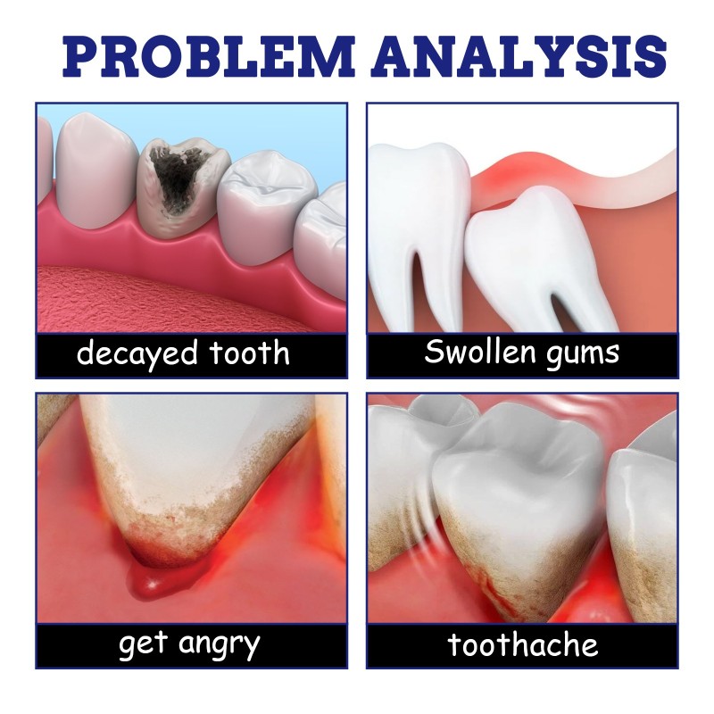 Toothache Spray Manufacturer - OEM Private Label Oral Hygiene Gingival Swelling Relief