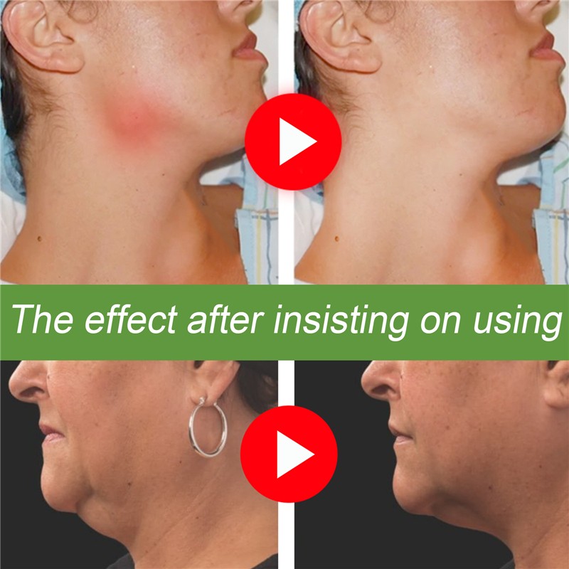 Neck Lymph Detox Patches Manufacturer - Private Label 12pcs Ginger Oil Red Clover Wormwood