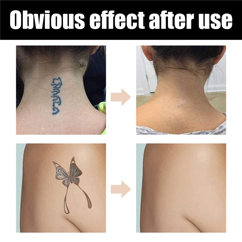 Tattoo Concealer Kit Manufacturer - EELHOE Waterproof Light Dark for Mark Burn Scar Spot