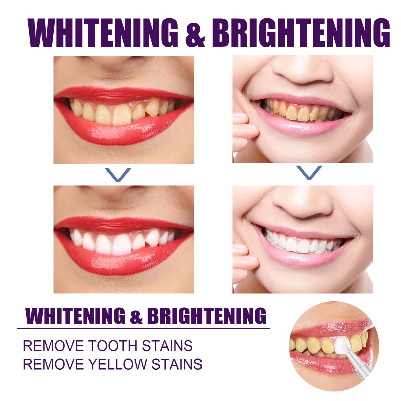 Tooth Whitening Pen Manufacturer - OEM/ODM Wholesale Private Label Purple Toner Cleaning