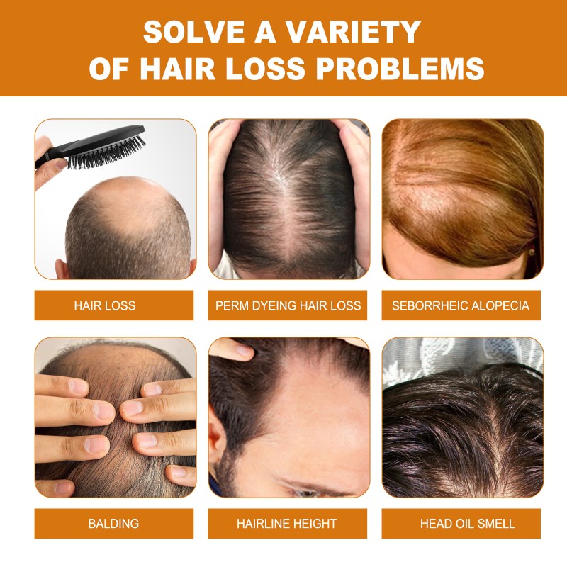 Rice Hair Shampoo Manufacturer - OEM/ODM Wholesale Deeply Cleanses Moisturizes Roots