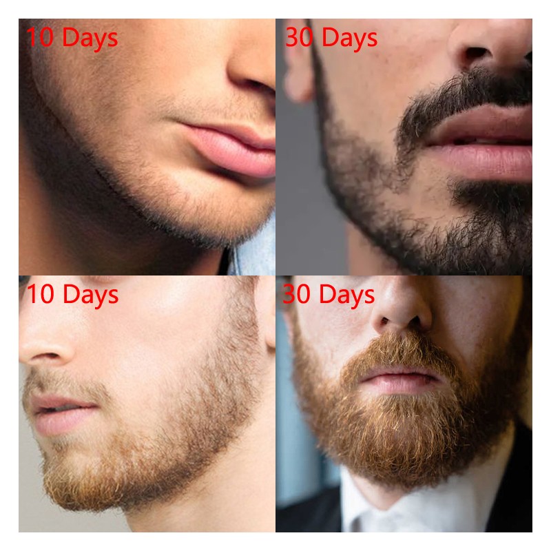 Beard Oil Manufacturer - Private Label Wholesale Custom OEM Professional Grooming Care