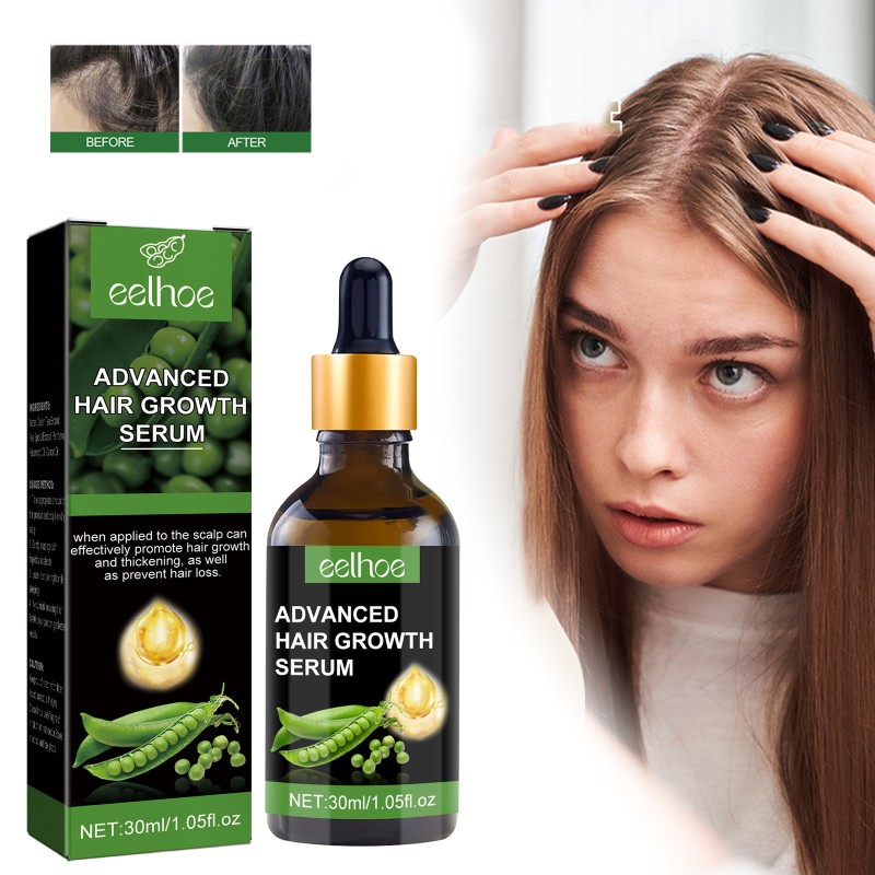 Hair Growth Serum Manufacturer - Custom Private Label EELHOE Advanced Stimulate Roots