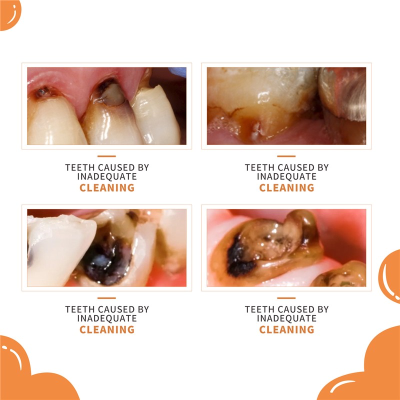 Kids Toothpaste Mousse Manufacturer - OEM Private Label Orange Flavor Children Cleaning