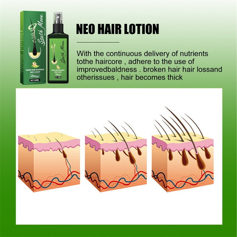 Hair Regrowth Spray Manufacturer - Private Label South Moon 100ml Green Ginger Loss Reducing