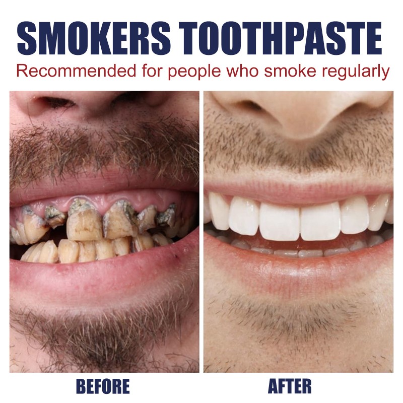 Smoker Toothpaste Manufacturer - OEM Private Label Custom Remove Tobacco Stains Effectively