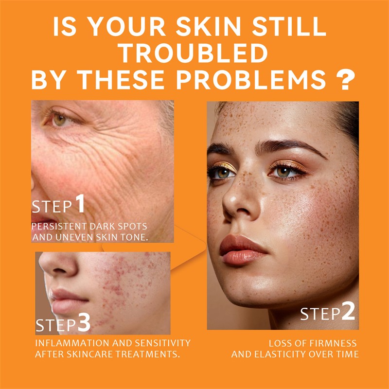 Face Cream Manufacturer - Private Label Custom 50g Turmeric Vitamin C Niacinamide Hydrating