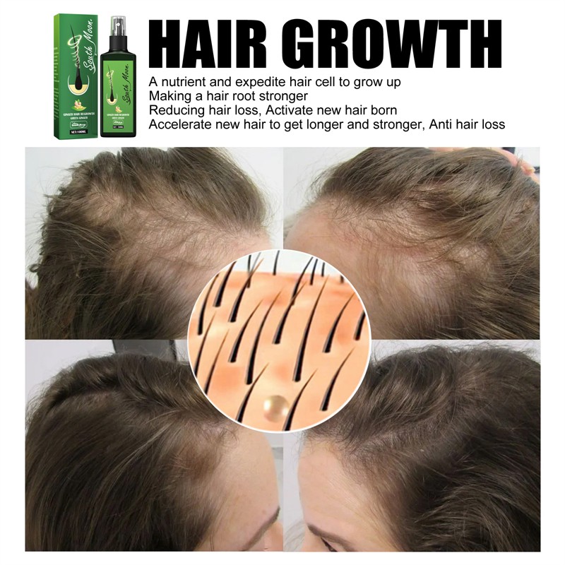 Hair Regrowth Spray Manufacturer - Private Label South Moon 100ml Green Ginger Loss Reducing