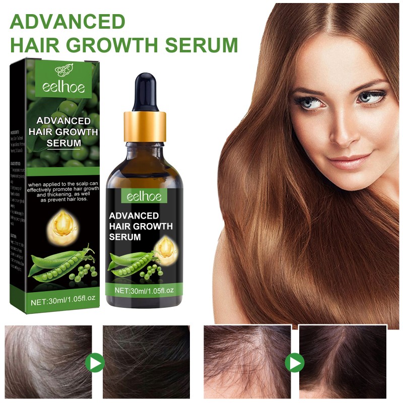 Hair Growth Serum Manufacturer - Custom Private Label EELHOE Advanced Stimulate Roots