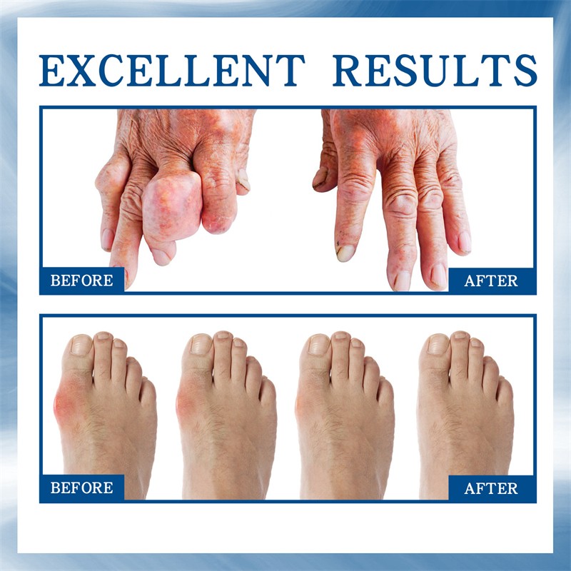 Joint Care Ball Fluid Manufacturer - Private Label Joint Bone Repair Sore Eliminating