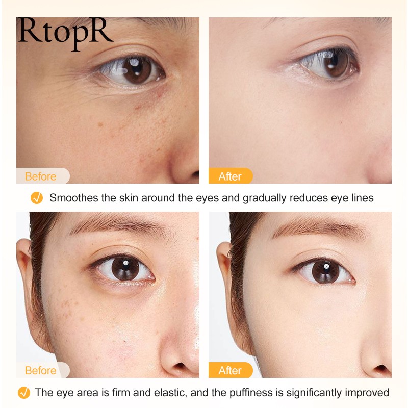 Vitamin C Eye Cream Manufacturer - Private Label Skin Moisturizing Dark Circles Improving